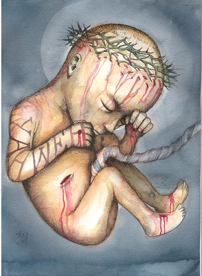 A painful, vulnerable, and sacred depiction of suffering.